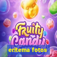 eritema fotos